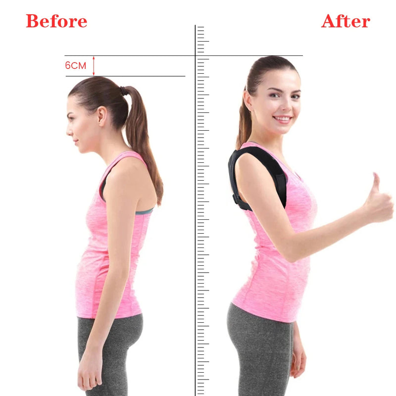 PostureAlign - Posture Corrector Belt